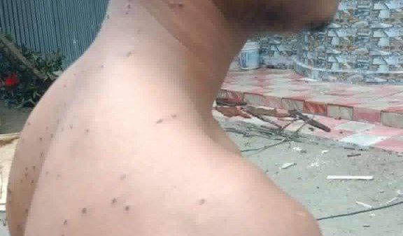 খুলনায় চিকিৎসার অভাবে ছটপট করছে গুলিবিদ্ধ নাঈম