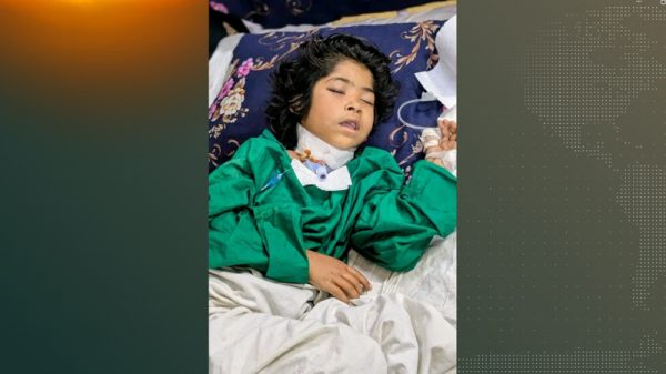 চট্টগ্রামের সীতাকুণ্ডের গলাকাটা সেই শিশুটিকে বাঁচানো গেল না